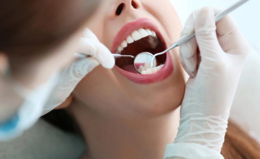 Kết quả sau khi niềng răng | Niềng răng đẹp cỡ nào? 