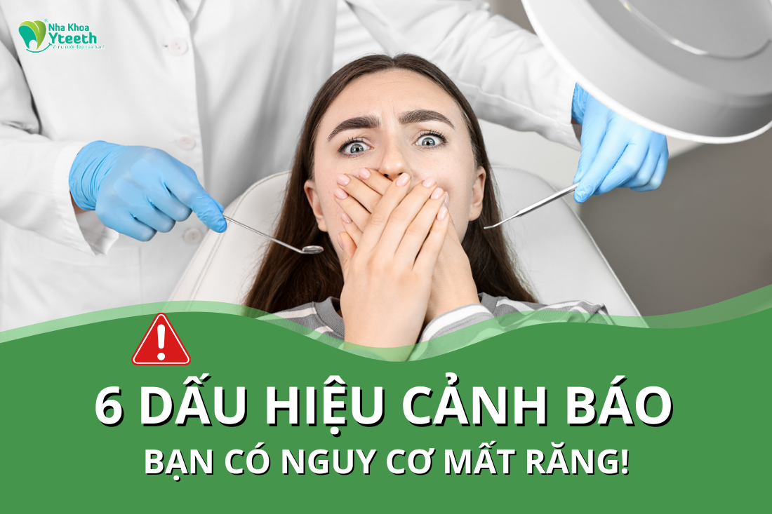 6 dấu hiệu cảnh báo bạn có nguy cơ mất răng