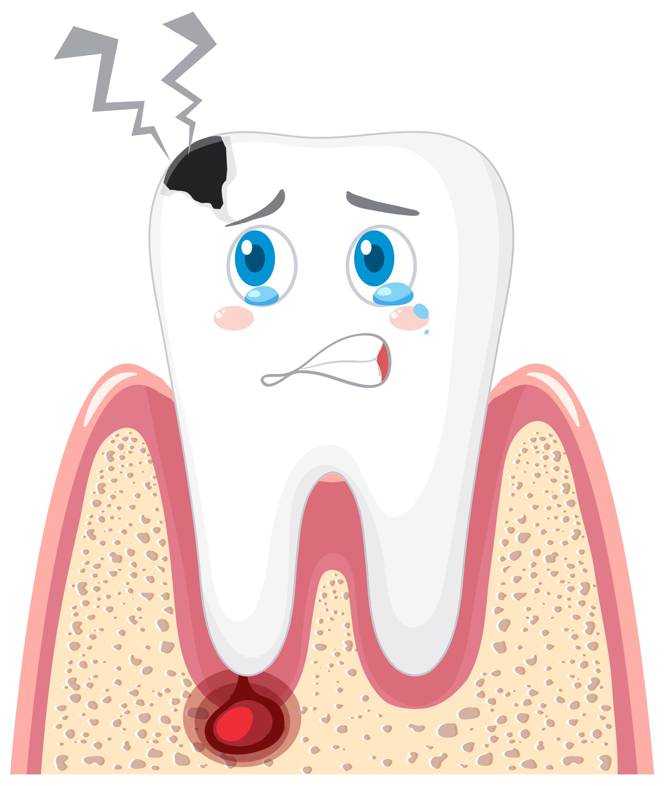 Nướu đỏ, sưng, dễ chảy máu khi đánh răng